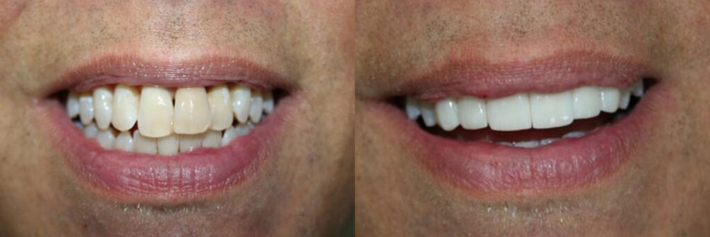 patient before and after