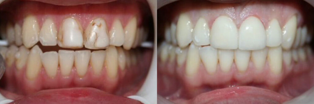 patient before and after