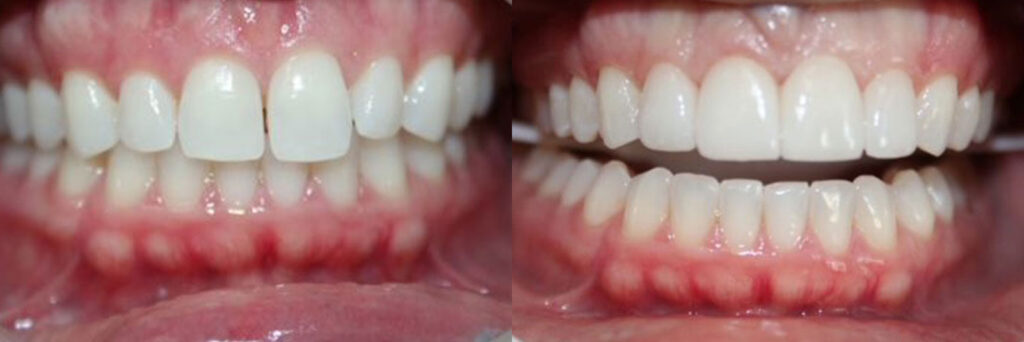 patient before and after