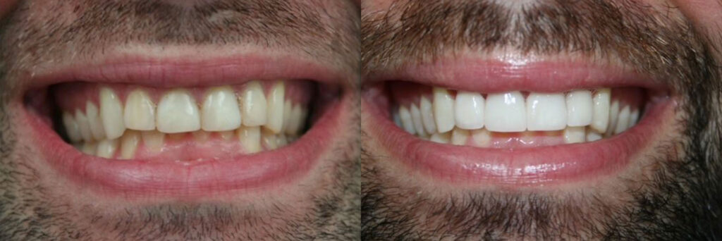 patient before and after